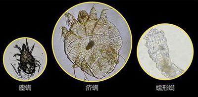 狗狗身上有螨虫会引发哪些皮肤病？