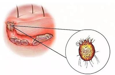 狗狗感染疥癣难根治？或许是方法不对